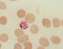 Human red blood cell infected by the malaria parasite Plasmodium falciparum, showing a residual body with brown hemozoin. P.falciparum schizont.jpg