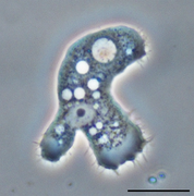 Acanthamoeba (Discosea)