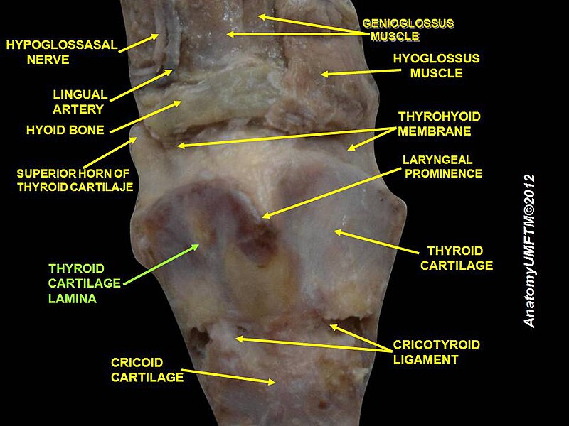 File:Slide3ooo.JPG