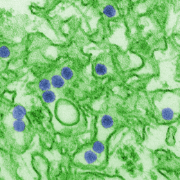 Elektronmikroszkópos kép a vírusról