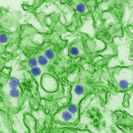 Scanning Electron Microscope image of Zika