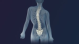 scoliosis Intervertibral Disc