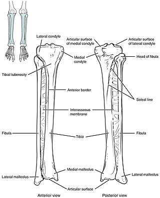 <span class="mw-page-title-main">Intraosseous infusion</span> Medical procedure of injecting medications into bone marrow