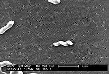 Scanning electron micrograph depicting a number of Campylobacter jejuni bacteria Campylobacter jejuni 5778 lores.jpg