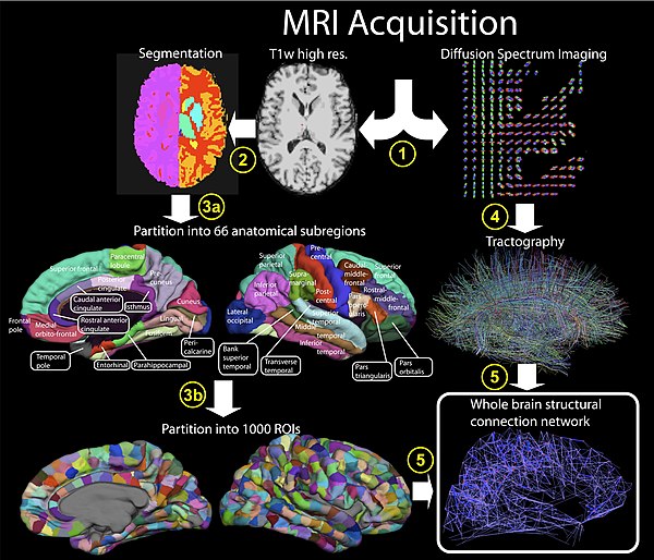 Process from MRI acquisition to whole brain structural network