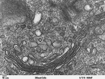 Micrograph of Golgi apparatus, visible as a stack of semicircular black rings near the bottom. Numerous circular vesicles can be seen in proximity to the organelle. Human leukocyte, showing golgi - TEM.jpg
