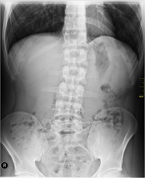 File:Medical X-Ray imaging QTY06 nevit.jpg