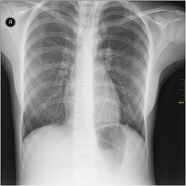 File:Medical X-Ray imaging SJE07 nevit.jpg