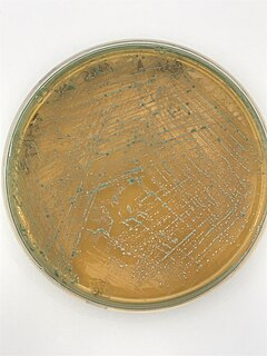 <span class="mw-page-title-main">MRS agar</span> Selective culture medium designed to favour the luxuriant growth of Lactobacilli for lab study