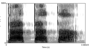 Spectrogram of a male voice saying 'ta ta ta'.
