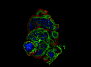 Immunofluorescence image of intestinal organoids generated using small intestine from ApcMin/+ mice, which carry an Apc mutation leading to the spontaneous development of intestinal tumours Abhimanu.pandey 22.4 5.833 out of 10, SD x