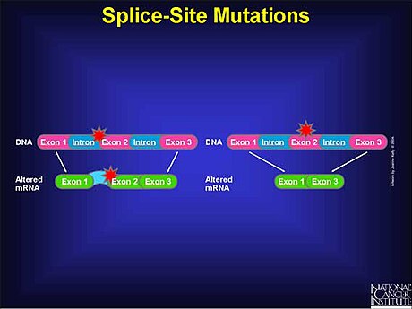 Splice site mutation