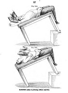 History of cardiopulmonary resuscitation - Wikipedia