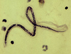 phylum aschelminthes wuchereria akinek parazita felülvizsgálata volt