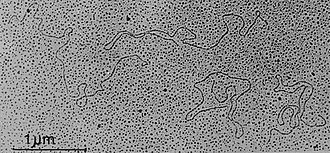 Transmission electron micrograph of dsRNA molecules of Oryza sativa endornavirus isolate Nipponbare. 1204 vir001277 Fig2.jpg