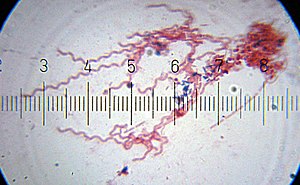 20100905 211652 Spirochetes.jpg