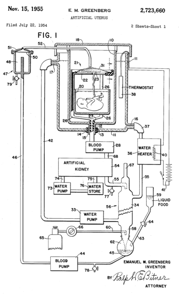 Artificial womb