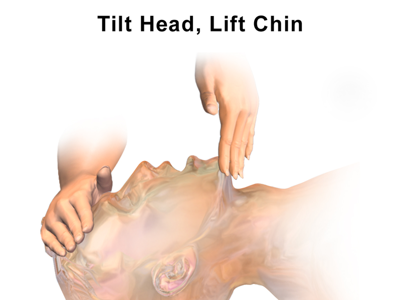 File:CPR Adult Airway.png