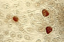 C. trachomatis inclusion bodies (brown) in a McCoy cell culture.