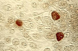 Внутриклеточные включения Chlamydia trachomatis в световом микроскопе