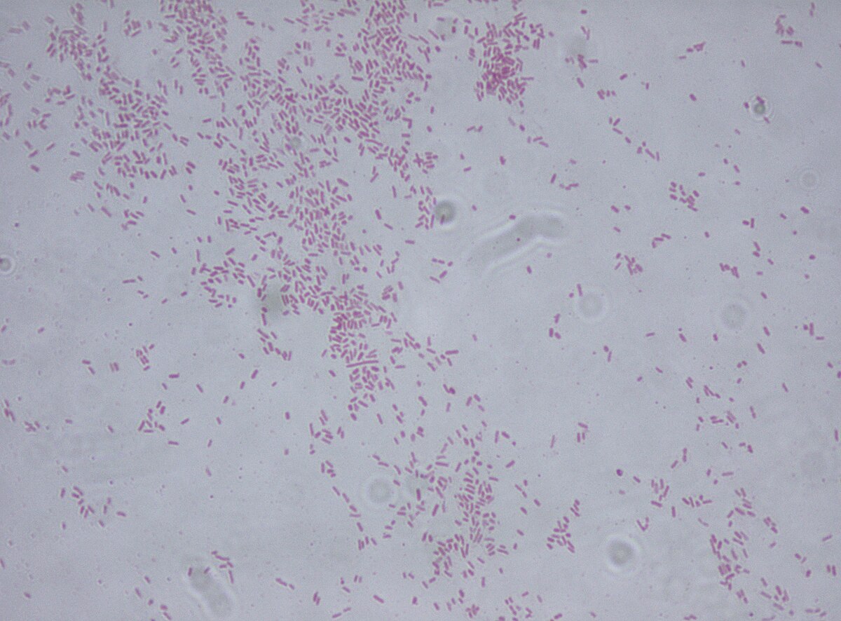 File:Staphylococcus aureus Gram stain.jpg - Wikimedia Commons