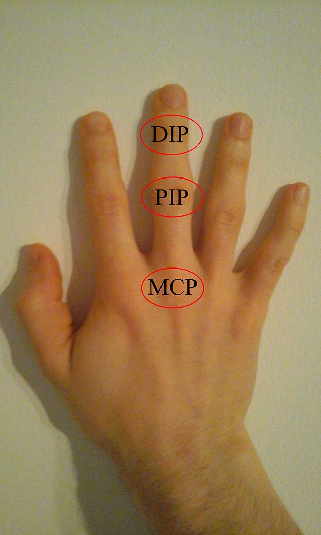 File:DIP, PIP MCP joints of hand.jpg - Commons