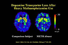 Dopamine Transporter Meth.jpg