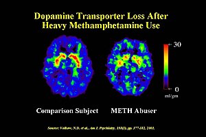 Dopamine Transporter Meth.jpg