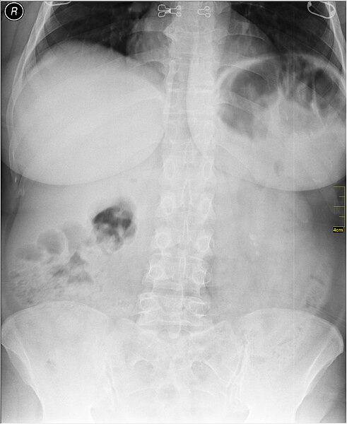 File:Medical X-Ray imaging SLL07 nevit.jpg