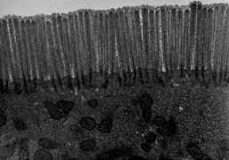 Transmission electron microscope (TEM) image of human jejunum