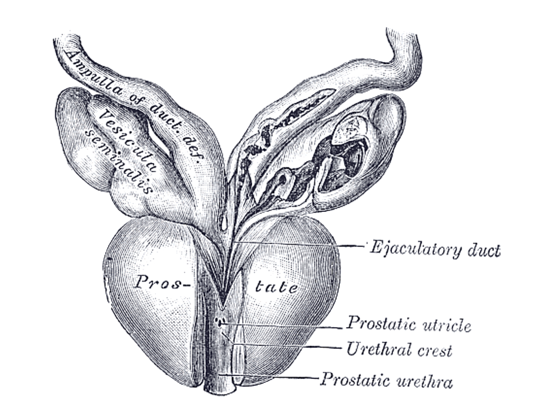 Prostatic utricle