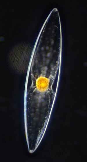 Pyrocystis fusiformis.jpg