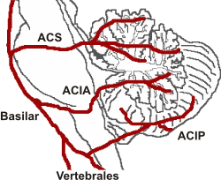 Arterie móżdżku en.svg