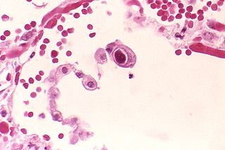 Human betaherpesvirus 5, also called human cytomegalovirus (HCMV), is the type species of the virus genus Cytomegalovirus, which in turn is a member of the viral family known as Herpesviridae or herpesviruses. It is also commonly called CMV. Within Herpesviridae, HCMV belongs to the Betaherpesvirinae subfamily, which also includes cytomegaloviruses from other mammals.