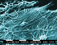 August 10: Scanning electron microscopic image of Ebola virions.