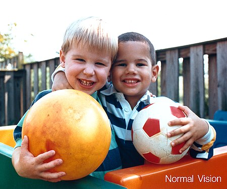 Tập_tin:Human_eyesight_two_children_and_ball_normal_vision_color.jpg
