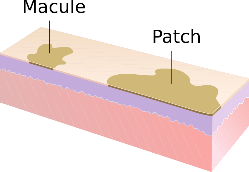 skin lesions description