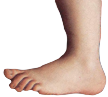 Cupid's foot, as used by Monty Python's Flying Circus. A trademark of Gilliam's stop-motion animation, the giant foot would suddenly squash things, including the show's title at the end of the opening credits.