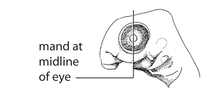 Standard Event System character depiction P4. Mandibular arch bud midline eye (G02d).png
