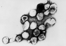 Rubellavirus