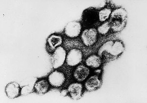 Rubella virus TEM B82-0203 lores.jpg