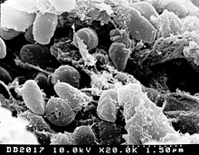 Yersinia pestis scanned with electron micrograph.jpg