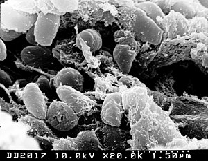 Yersinia pestis mit elektronenmikroskopischer Aufnahme gescannt.jpg