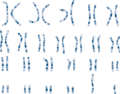 Chromosomes image - Karyotype