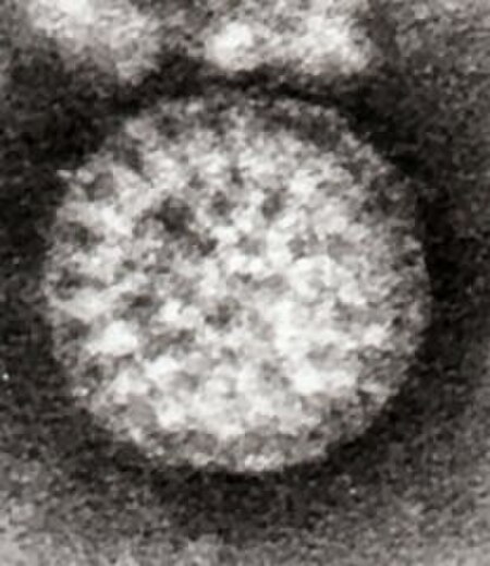 Tập_tin:Flewett_Rotavirus.jpg