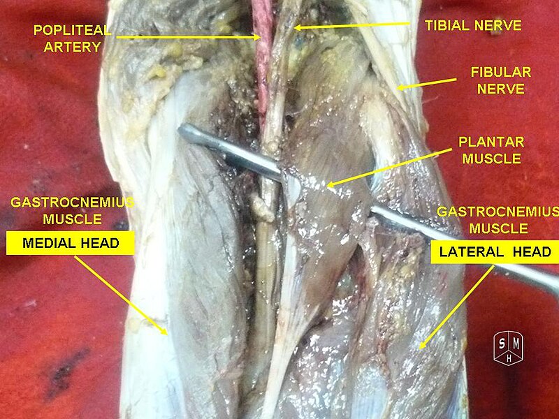 File:Gastrocnemius muscle 3.jpg