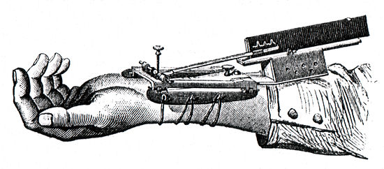 Apparatus for measuring and indicating blood-pressure (1914, F. Faught