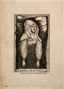 Martha Hatfield, die eine Trance hatte, aus der sie Divi Wellcome V0007121.jpg gewann