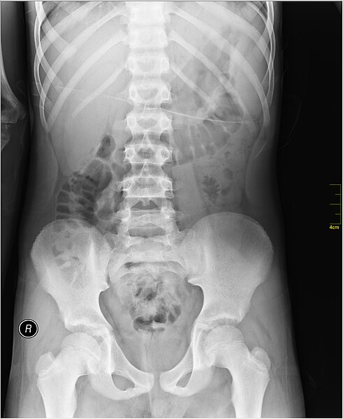 File:Medical X-Ray imaging SIP07 nevit.jpg