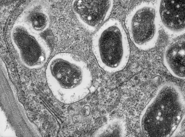 Transmission electron microscope image of a cross section through a soybean (Glycine max) root nodule. The nitrogen fixing bacteria, Bradyrhizobium ja